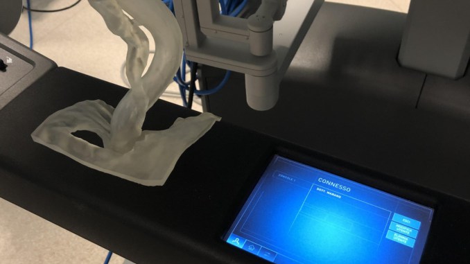 In Umbria donna salvata grazie al primo intervento chirurgico con la stampa 3D