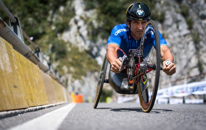 Alex Zanardi parti del cranio ricostruite con la stampa3D