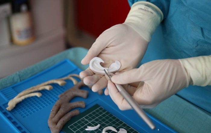 Stampa 3D ricostruito osso temporale al Santobono-Pausilipon di Napoli